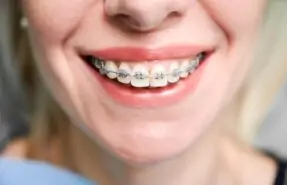 ortodonti-tedavileri