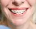 ortodonti-tedavileri