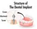 dentis-implant-markasi-nedir-