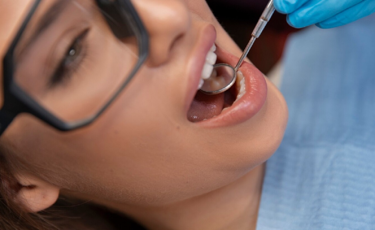 dental-implant-cesitleri