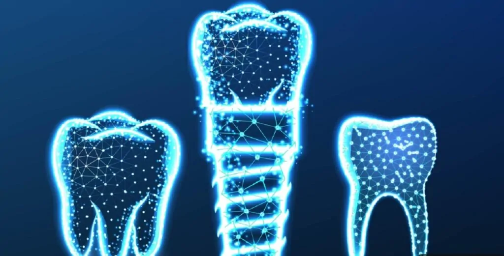 1-implant-kac-dis-tutar