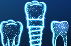 1-implant-kac-dis-tutar