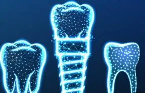 1-implant-kac-dis-tutar