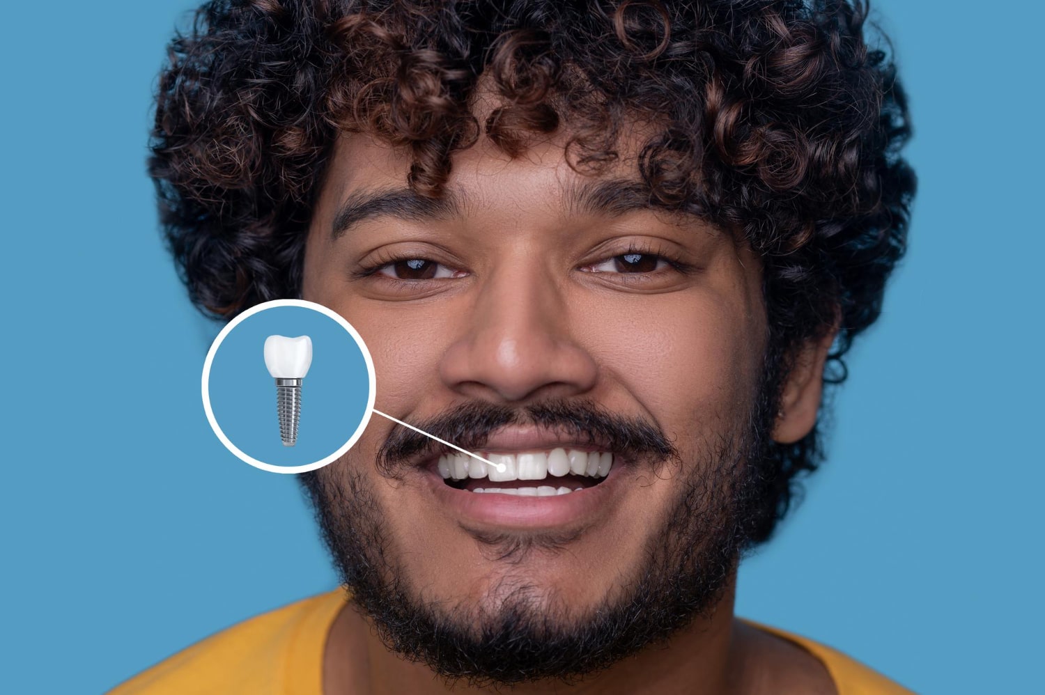 İstanbul'da Dental İmplant Tedavisi