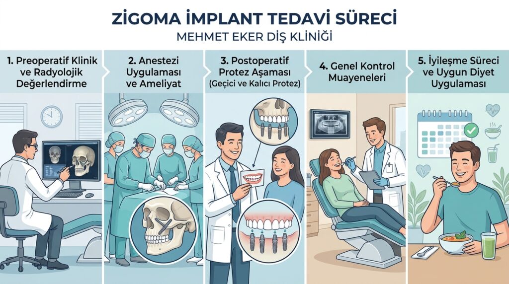 zigoma-implant-tedavisi